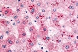 PYGL Antibody, Novus Biologicals 50 &mu;g | Buy Online | Novus Biologicals | Fisher Scientific